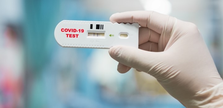 1671054132_antigen-testing-available-in-sa-720x350px.jpg
